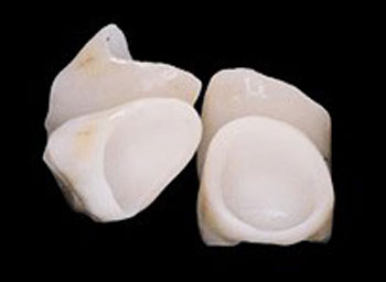 Ceramic