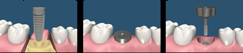 Dental