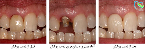 procedure
