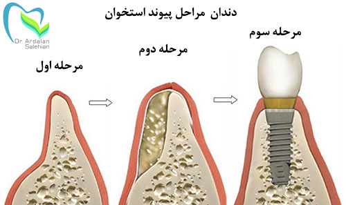 Procedure